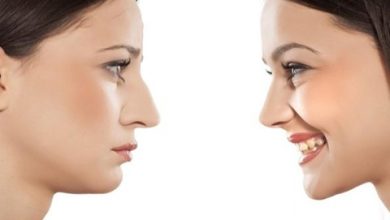 غضروف طبیعی یا مصنوعی؟ کدام پیوند تضمینکننده ماندگاری و نتیجه بهتر در جراحی بینی است؟ 2 غضروف طبیعی یا غضروف مصنوعی دکتر مفرد