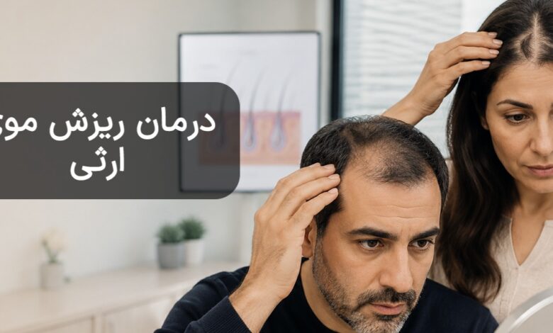 ریزش موی ارثی