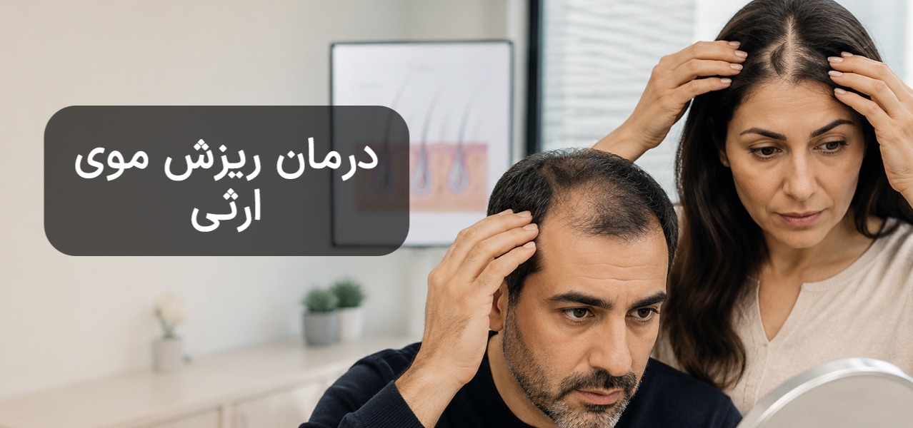 ریزش موی ارثی